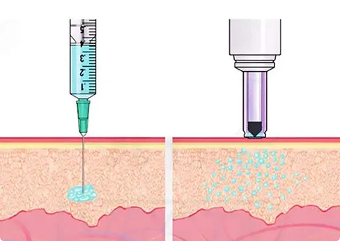 Electric Needle Free Injection System Needle Free Jet injector Gun